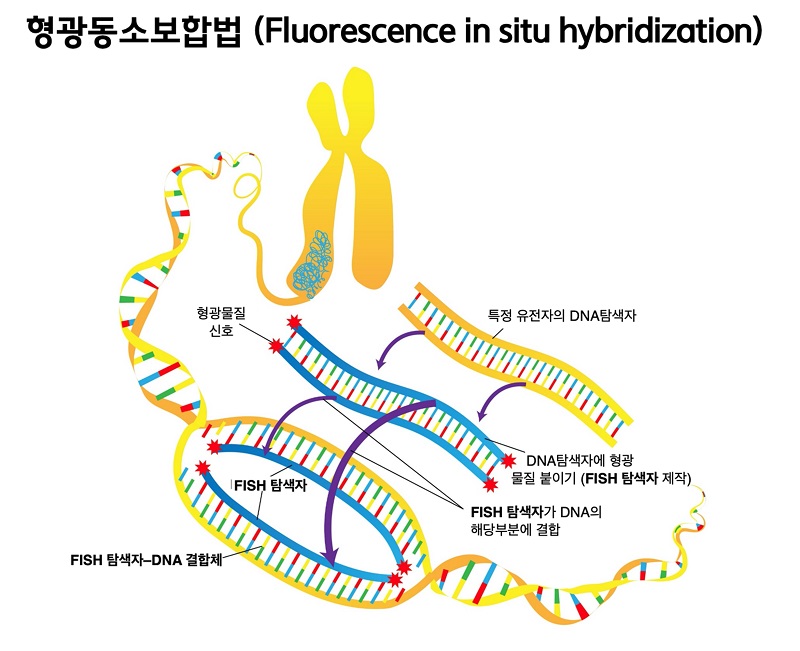 형광동소보합법 (Fluorescenece in situ hybridization) 그림. 1.특정 유전자의 DNA탐색자에 형광 물질 붙이기(FISh탐색자 제작). 2.FISh탐색자가 DNA의 해당부분에 결합. 3.FISh탐색자-DNA 결합체.