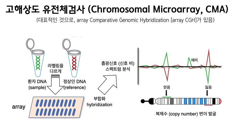 고해상도 유전체검사(Chromosomal Microarray, CMA) (대표적인 것으로, array Comparative Genomic Hybridization [array CGH]가 있음) 1.환자 DNA(sample)과 정상인 DNA(reference)의 라벨링을 다르게 표시하여 array를 만든다. 해당 array를 부합화(hybridization)하여 흡광신소 (신호 비) 스펙트럼 분석을 통해 복제수 (copy number) 변이 발굴을 한다.