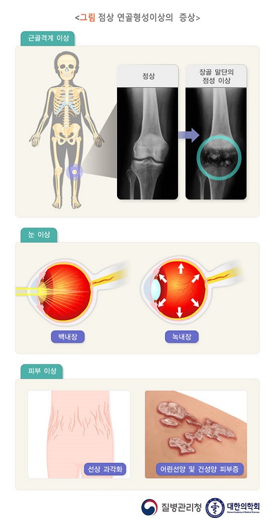 에리히증의 증상, 원인 및 치료