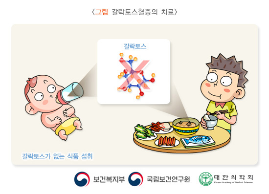갈락토스 혈증의 치료