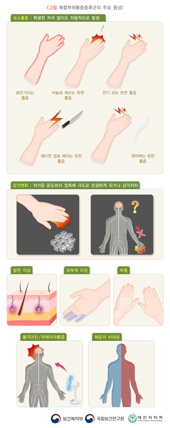 복합부위통증증후군의 주요 증상