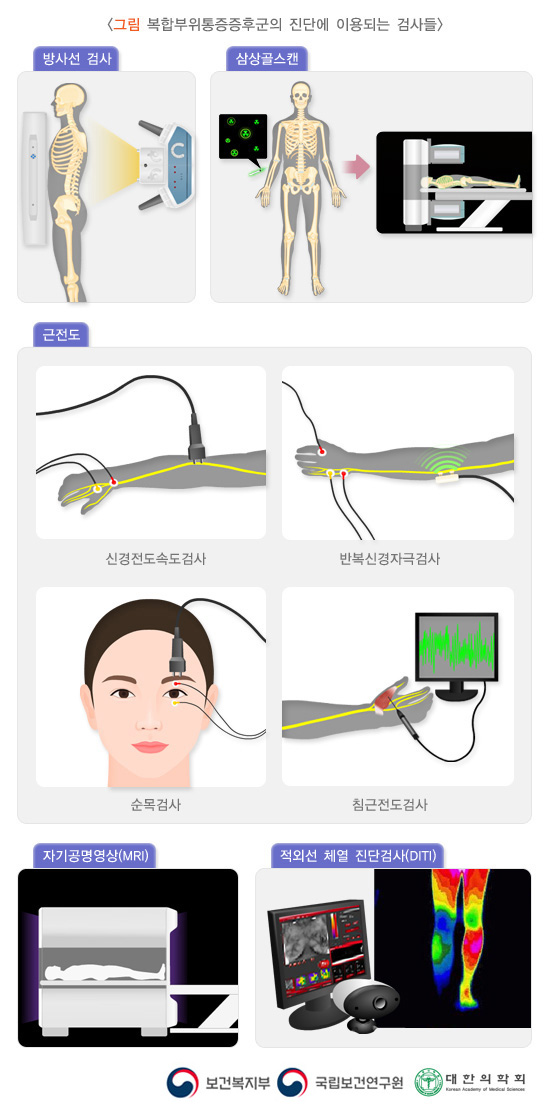 복합부위통증증후군 진단에 이용되는 검사들