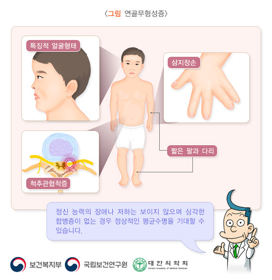 연골무형성증