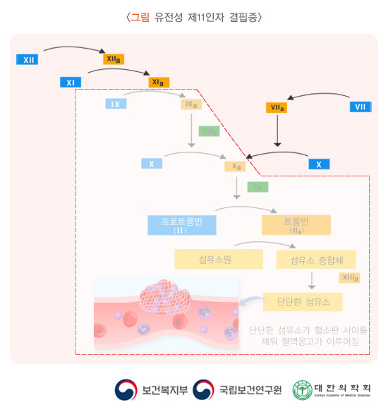 유전성 제11인자 결핍증