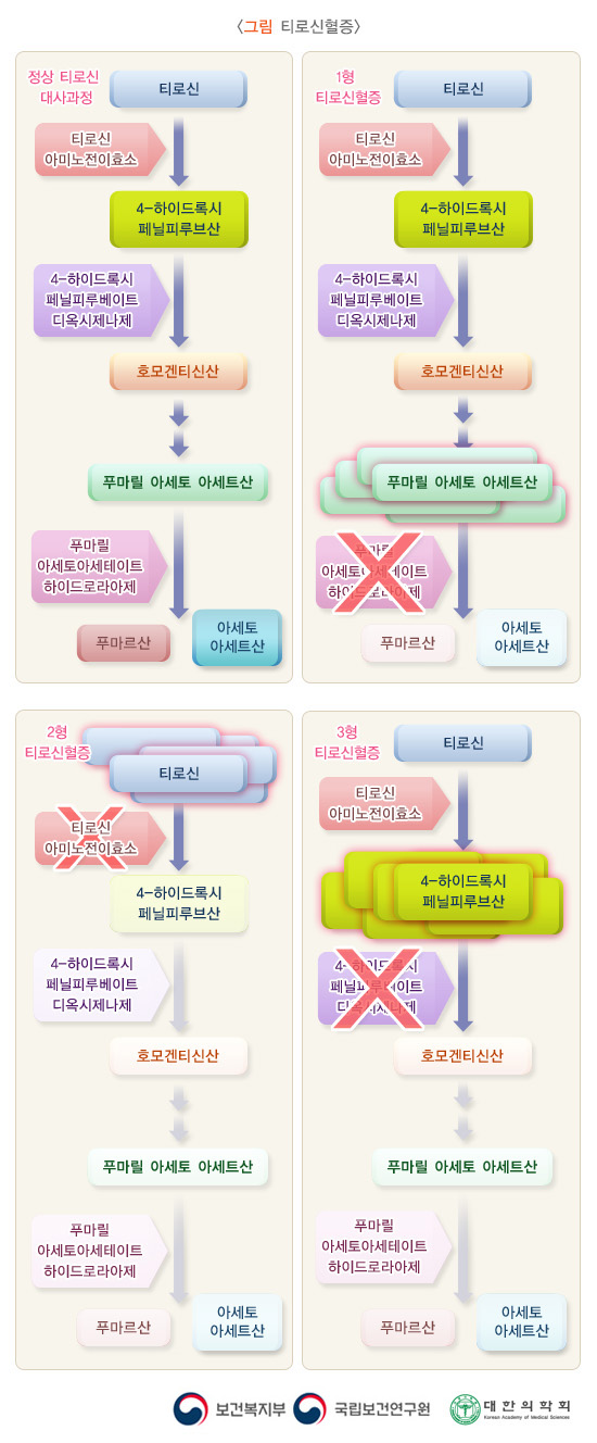 티로신혈증