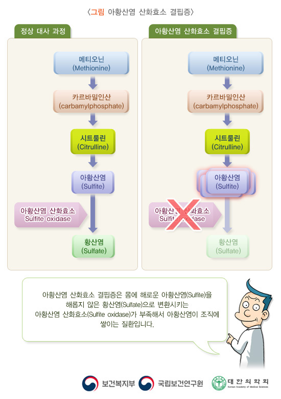 아황산염 산화효소 결핍증