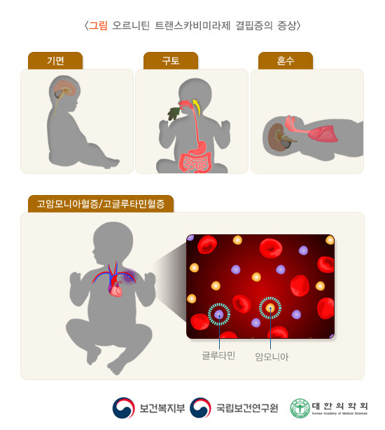 오르니틴 트랜스카비미라제 결핍증의 증상