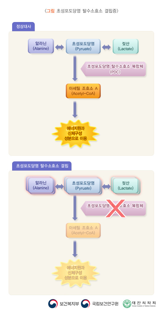 초성포도당염 탈수소효소 결핍증