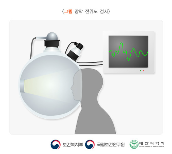 망막 전위도 검사